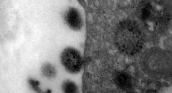 Covid-19: anticorpos podem durar até 12 meses após infecção